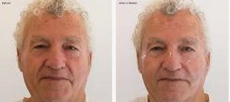 Uuth Aging Skin 7 (1).JPG Uuth Aging Skin 7 (1).JPG